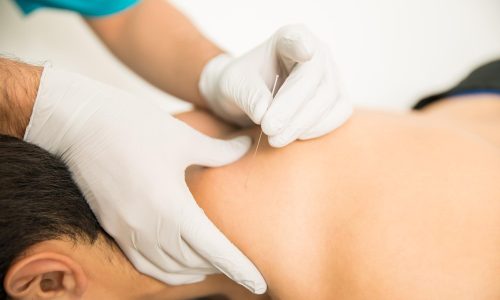 Dry Needling & Manual Therapy
